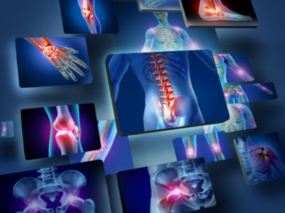 orthopedics