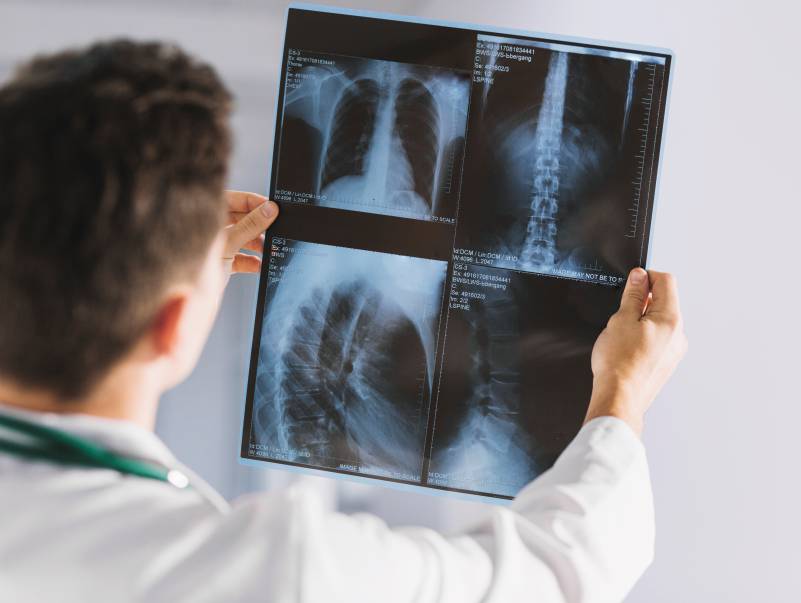 x-ray