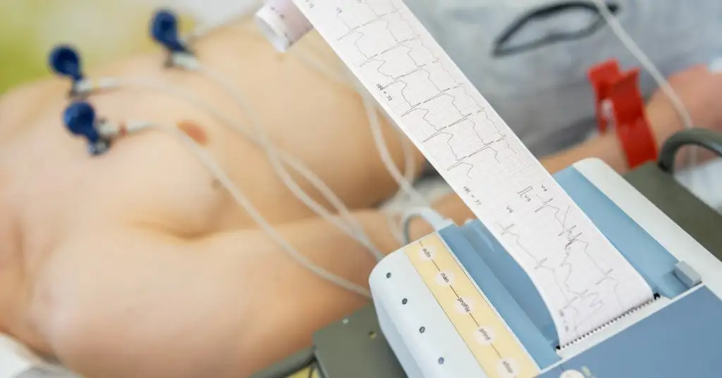 what-is-an-ecg-machine-complete-guide